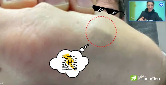 อย่าหาทำ! หนุ่มบิตคอยน์ฝังชิปในมือเพื่อชำระบิตคอยน์ โดยไร้ตัวช่วย