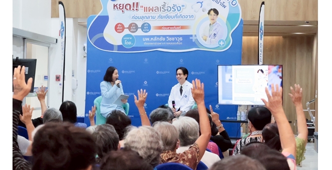 แพทย์ชี้เส้นเลือดขอด ภัยเงียบแต่ร้ายแรง! เสี่ยงแผลเรื้อรัง-เสียขา ไม่รู้ตัว